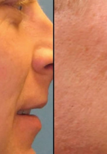 Что делать, если болят уши после бассейна?