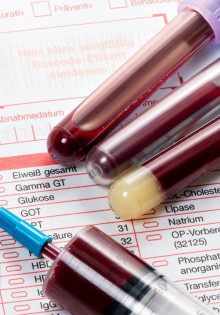 Когда необходимо сдавать клинический анализ крови?