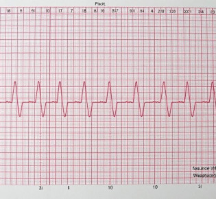 ЭКГ без паники: как читать линии на бумаге и понимать сердце