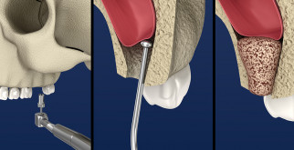 Обыкновенный уж: загадочный обитатель водоемов