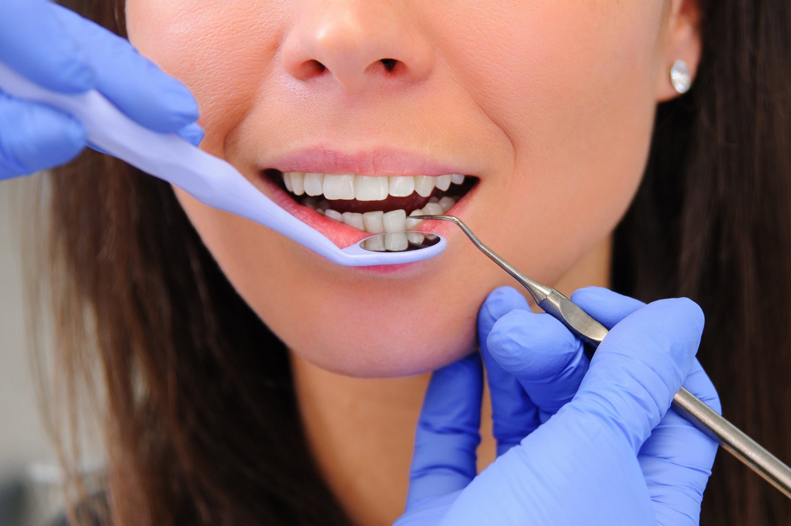 Профилактика стоматологических заболеваний