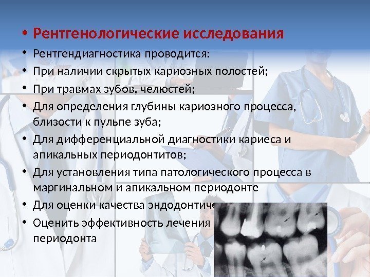 Как проводится рентген-диагностика состояния зубов?