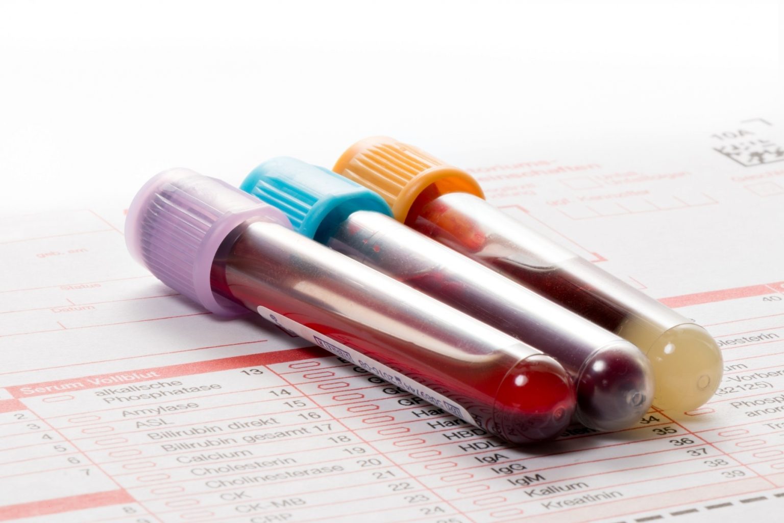 Когда необходимо сдавать клинический анализ крови?