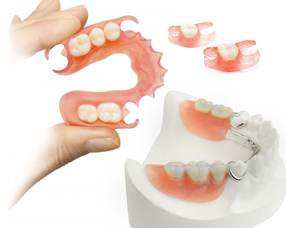 Что входит в стоимость протезирования зубов?