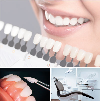 Ультратонкие виниры для различных стоматологических проблем