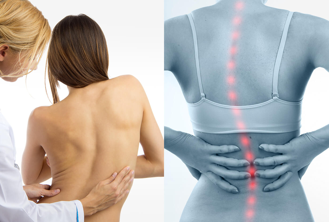 Лечение сколиоза: как вернуть здоровую позу спины
